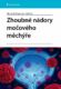 Zhoubné nádory močového měchýře (e-kniha)