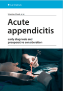 Acute appendicitis (e-kniha)