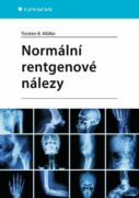 Normální rentgenové nálezy (e-kniha)