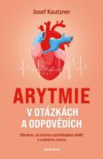 Arytmie v otázkách a odpovědích (e-kniha)