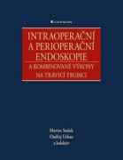 Intraoperační a perioperační endoskopie a kombinované výkony na trávicí trubici (e-kniha)