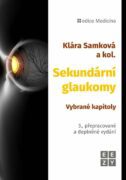 Sekundární glaukomy - Vybrané kapitoly